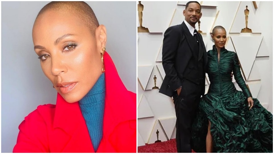 Jada Pinkett Smith has been struggling with a medical condition called alopecia areata which leads to acute hair loss. (Instagram/Jada Pinkett Smith, Reuters) Jada Pinkett Smith has been struggling with a medical condition called alopecia areata which leads to acute hair loss. (Instagram/Jada Pinkett Smith, Reuters)