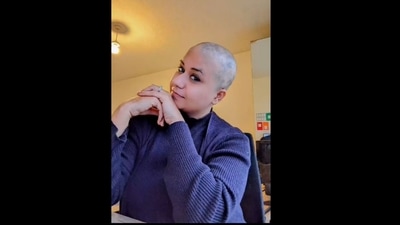 Shaily Malik decided to embrace her baldness and bring awareness about alopecia through her Instagram account. (bald_mummy/Instagram) Shaily Malik decided to embrace her baldness and bring awareness about alopecia through her Instagram account. (bald_mummy/Instagram)