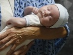 Stabilising low blood sugar in infancy prevents brain damage in long term