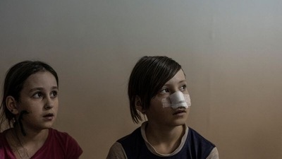 Two 11-year-old kids, Milana and Sasha, who were wounded during the shelling of Mariupol, in a hospital. (REUTERS)