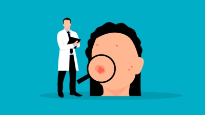 Fitness experts reveal effects of PCOS on skin, hair health (Pixabay) Fitness experts reveal effects of PCOS on skin, hair health (Pixabay)