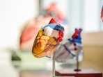 Heart complications after ischemic stroke increase risk of cardiovascular events Heart complications after ischemic stroke increase risk of cardiovascular events