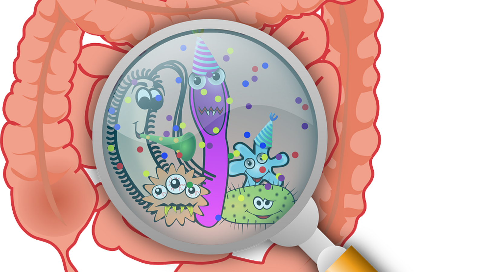 Sobrecrecimiento bacteriano intestinal