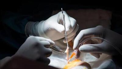 Over 1,600 patients await a kidney transplant and have registered for the same, such rackets help patients with money to skip the line while exploiting the poor. (REPRESENTATIVE PHOTO) Over 1,600 patients await a kidney transplant and have registered for the same, such rackets help patients with money to skip the line while exploiting the poor. (REPRESENTATIVE PHOTO)