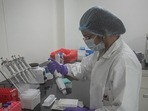 The XE appears to be the result of a recombination of the BA.1 and BA.2, the first two Omicron variant lineages that spread widely.(Pratham Gokhale/HT file photo) The XE appears to be the result of a recombination of the BA.1 and BA.2, the first two Omicron variant lineages that spread widely.(Pratham Gokhale/HT file photo)
