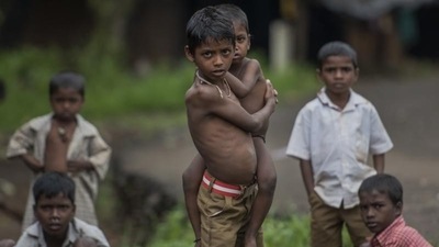 Prevalence of malnutrition remains high at 35.5% stunting; 19% wasting, and 32.1% underweight including a high prevalence of anaemia and micronutrient deficiency disorders. (Satish Bate/HT PHOTO)
