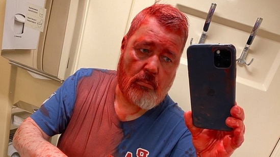 Nobel Peace Prize-winning newspaper editor Dmitry Muratov takes a selfie after he said he was attacked on a Russian train by an assailant.(AP)