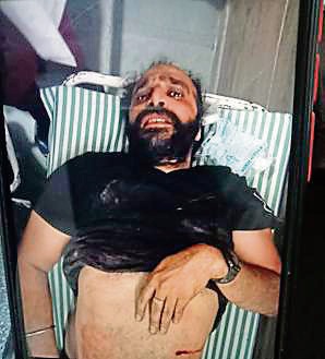 Victim Harvinder Singh, a resident of Ropar. (HT Photo)