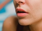 Lips can get dry in summer season too.