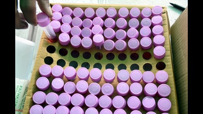 Health experts have said that continuous monitoring of wastewater samples for Covid-19 will play a key role in the coming days. (HT PHOTO) Health experts have said that continuous monitoring of wastewater samples for Covid-19 will play a key role in the coming days. (HT PHOTO)