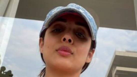 Malaika Arora shares her first picture after accident.