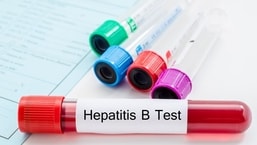 Les virus des hépatites de types A, B, C et E qui causent habituellement ces maladies ont été exclus des tests de laboratoire.