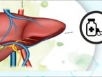 World Liver Day 2022: Do painkillers harm the liver? Here's what doctors say&nbsp;