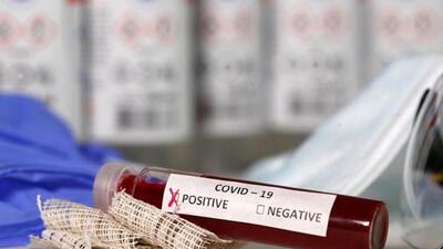 On April 19, eight Covid cases were reported in Ludhiana. (HT FILE)