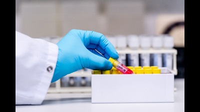 A well-equipped laboratory will be set up to promote research in cancer medicine and treatment in Shivajinagar, Pune (REPRESENTATIVE IMAGE) A well-equipped laboratory will be set up to promote research in cancer medicine and treatment in Shivajinagar, Pune (REPRESENTATIVE IMAGE)
