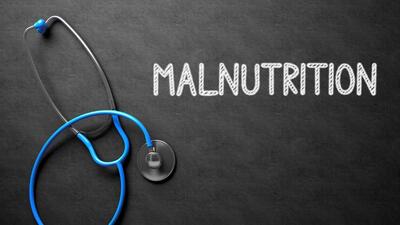 Medical Concept: Black Chalkboard with Malnutrition. Medical Concept: Malnutrition Handwritten on Black Chalkboard. Top View of Blue Stethoscope on Chalkboard. 3D Rendering. (tashatuvango - Fotolia) Medical Concept: Black Chalkboard with Malnutrition. Medical Concept: Malnutrition Handwritten on Black Chalkboard. Top View of Blue Stethoscope on Chalkboard. 3D Rendering. (tashatuvango - Fotolia)