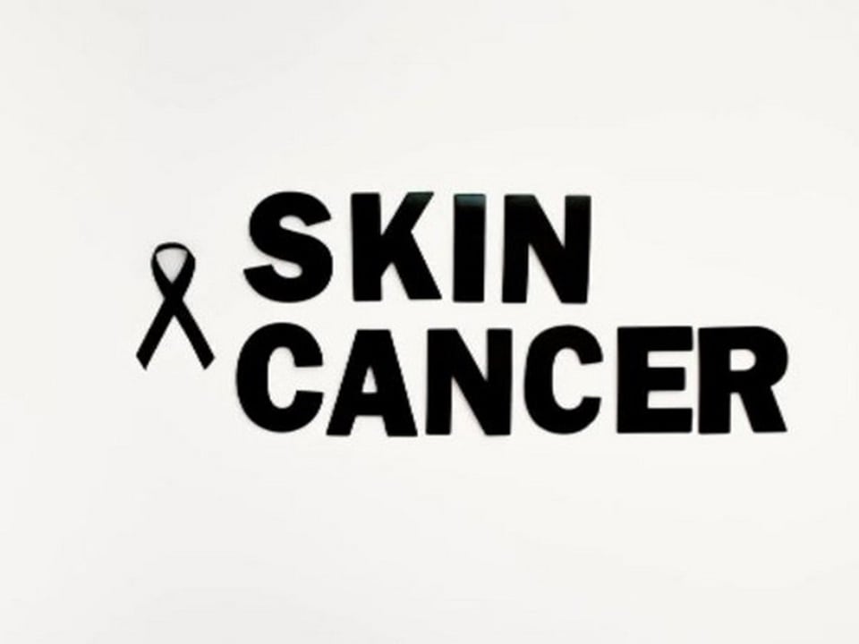 Merkel cell carcinoma is a life-changing diagnosis. It can be time-consuming, costly and exhausting to undergo clinic visits, imaging studies and blood draws. (ANI) Merkel cell carcinoma is a life-changing diagnosis. It can be time-consuming, costly and exhausting to undergo clinic visits, imaging studies and blood draws. (ANI)