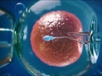 Self-cycle IVF: Fertility expert explains what is donor cycle IVF, who benefits from it&nbsp;