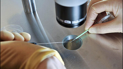 In vitro fertilisation (IVF) treatment in private hospitals is expensive and poor couples cannot afford it as it costs over one lakh rupees to complete one course of treatment (REPRESENTATIVE IMAGE) In vitro fertilisation (IVF) treatment in private hospitals is expensive and poor couples cannot afford it as it costs over one lakh rupees to complete one course of treatment (REPRESENTATIVE IMAGE)