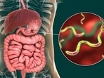 Ulcer: Doctors reveal causes, symptoms you should never ignore, treatment&nbsp;