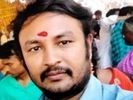 Acid Attack accused, Nagesh, is on the run after throwing 1 litre acid on a 24-year-old girl in Bengaluru Acid Attack accused, Nagesh, is on the run after throwing 1 litre acid on a 24-year-old girl in Bengaluru