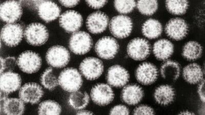 Rotavirus is a virus that spreads easily among infants and young children. The virus can cause severe watery diarrhoea, vomiting, fever, and abdominal pain. (Stock Pic) Rotavirus is a virus that spreads easily among infants and young children. The virus can cause severe watery diarrhoea, vomiting, fever, and abdominal pain. (Stock Pic)