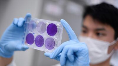 Chandigarh tricity area recorded 18 fresh Covid cases. (AFP) Chandigarh tricity area recorded 18 fresh Covid cases. (AFP)