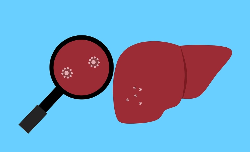 Adenoviruses are a large group of viruses that can infect a wide range of animals as well as humans. (Pixabay) Adenoviruses are a large group of viruses that can infect a wide range of animals as well as humans. (Pixabay)