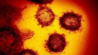 At 16, majority of Saturday’s fresh cases were recorded in Mohali, a first since March 4, when 17 cases were reported. Another 12 people were found infected in Chandigarh and five in Panchkula. (AP) At 16, majority of Saturday’s fresh cases were recorded in Mohali, a first since March 4, when 17 cases were reported. Another 12 people were found infected in Chandigarh and five in Panchkula. (AP)