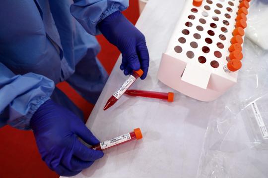 Representational image.