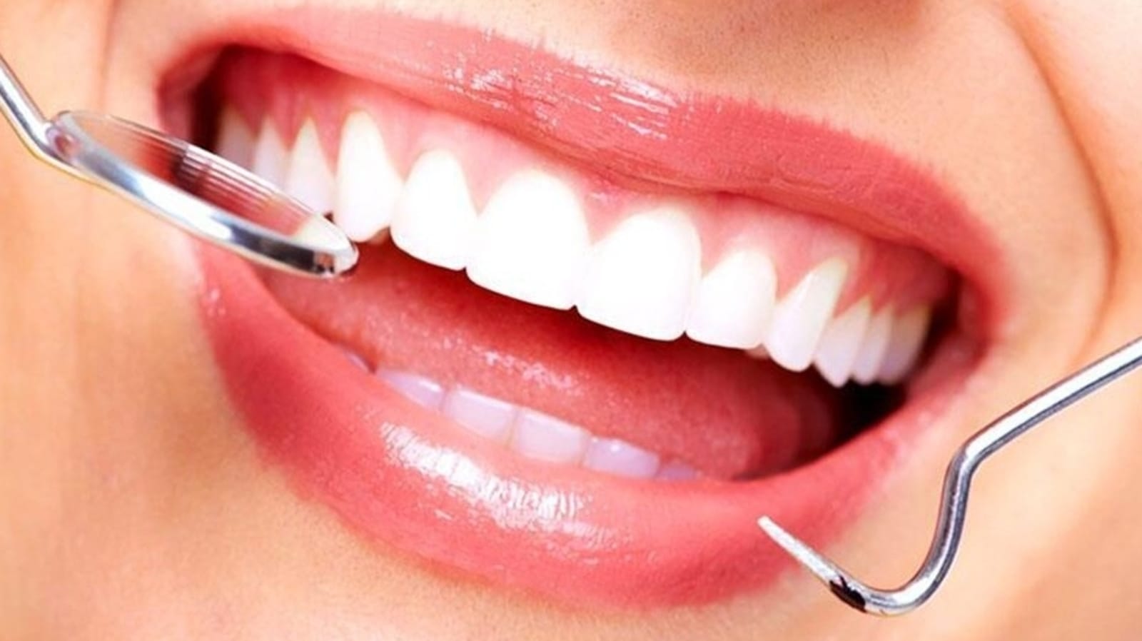 Gum Health Day 2022: Take care of your gums with these simple tips