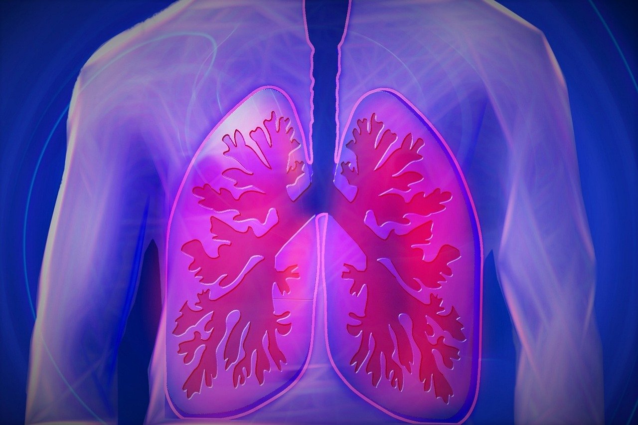 Researchers found that the COPD airway cells had 24-fold greater infection with SARS-CoV-2 than the healthy cells. (Pixabay) Researchers found that the COPD airway cells had 24-fold greater infection with SARS-CoV-2 than the healthy cells. (Pixabay)