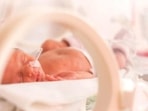 An infant in NICU.(Twitter/ASHAWeb) An infant in NICU.(Twitter/ASHAWeb)