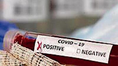 Chandigarh tricity area reported 27 new Covid infections. (HT File)