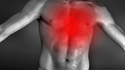 Pressure, tightness, pain, or a squeezing or aching sensation in your chest or arms that may spread to your neck, jaw or back. (Pixabay) Pressure, tightness, pain, or a squeezing or aching sensation in your chest or arms that may spread to your neck, jaw or back. (Pixabay)