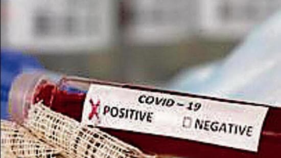 Chandigarh tricity area reported 27 new Covid infections. (HT File)