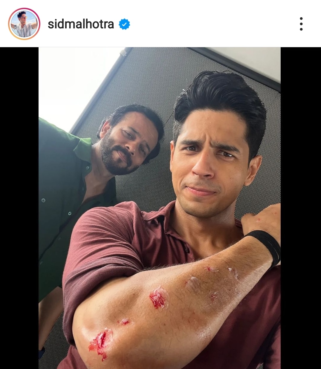 Actor Sidharth Malhotra showed off his arm injury in a new Instagram photo.