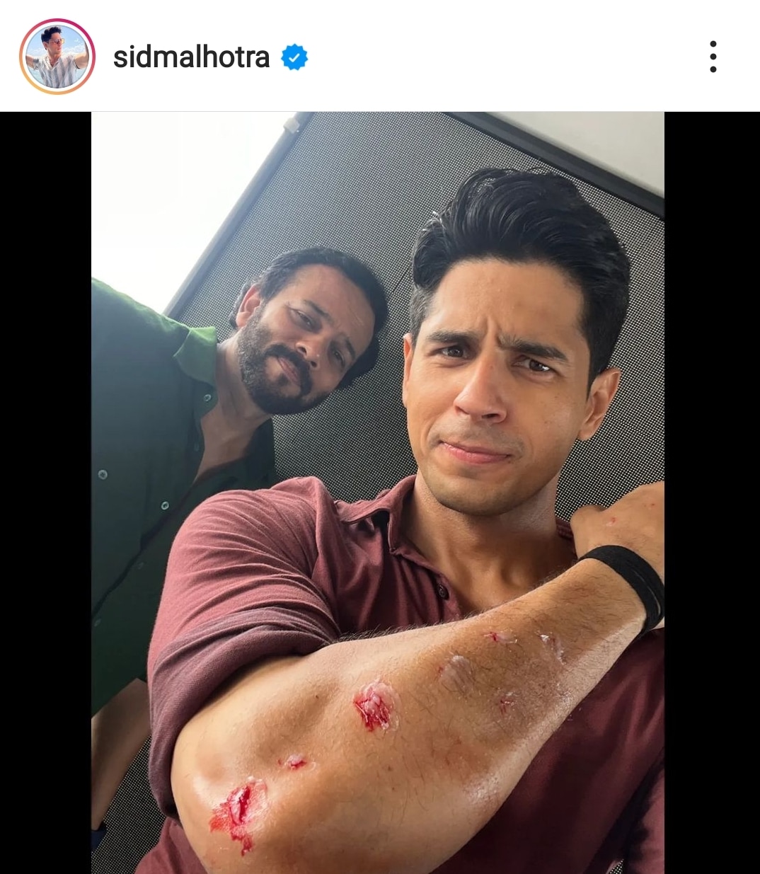 Sidharth Malhotra posted this selfie with Rohit Shetty shortly after his on-set accident. Sidharth Malhotra posted this selfie with Rohit Shetty shortly after his on-set accident. 