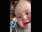 The Instagram video shows a cute baby with Down Syndrome saying ‘mama’ for the first time. (Instagram/@makingmilliestones)