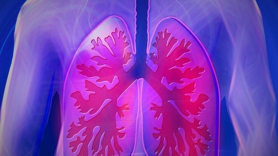 Researchers found that the COPD airway cells had 24-fold greater infection with SARS-CoV-2 than the healthy cells.(Pixabay)