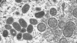 Uma imagem de microscopia eletrônica (EM) mostra partículas de vírus da varíola de macaco maduras e ovais.