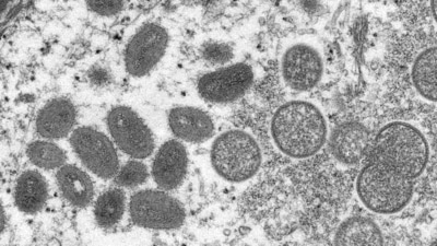 An electron microscopic (EM) image shows mature, oval-shaped monkeypox virus particles. (REUTERS)
