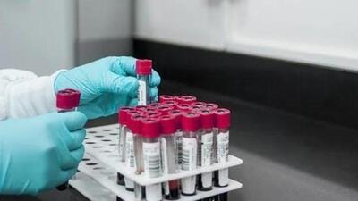 The patients who require repeated tests for prolonged periods will also get lab tests, X-rays and other investigations done free of cost at AIIMS Delhi. The patients who require repeated tests for prolonged periods will also get lab tests, X-rays and other investigations done free of cost at AIIMS Delhi.