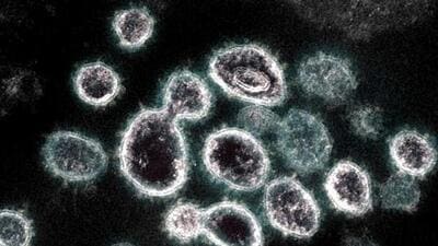 Chandigarh tricity area reported 23 fresh Covid infections. (AFP) Chandigarh tricity area reported 23 fresh Covid infections. (AFP)