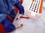 With 6,037 samples examined during the day, the number of tests in MP went up to 2,92,47,111. With 6,037 samples examined during the day, the number of tests in MP went up to 2,92,47,111.
