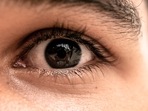 How often does your eyelid twitch? Here are its real causes, treatment solutions (Photo by Well Cabral on Unsplash)
