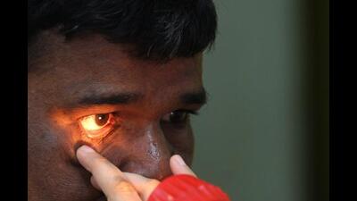 The girl was subsequently operated upon under the RBSK scheme at the district civil hospital, Aundh (REPRESENTATIVE IMAGE) The girl was subsequently operated upon under the RBSK scheme at the district civil hospital, Aundh (REPRESENTATIVE IMAGE)