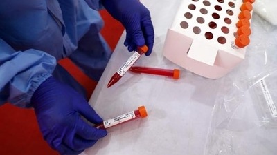 With 6,037 samples examined during the day, the number of tests in MP went up to 2,92,47,111.