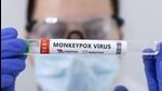A Test tubes labelled ‘Monkeypox virus positive’ is seen in this illustration taken on May 23. (REUTERS) A Test tubes labelled ‘Monkeypox virus positive’ is seen in this illustration taken on May 23. (REUTERS)