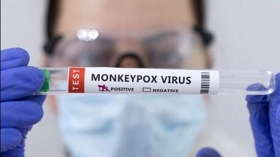 A Test tubes labelled ‘Monkeypox virus positive’ is seen in this illustration taken on May 23. (REUTERS)